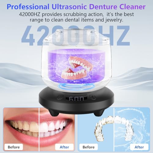 Ultrasonic Retainer Cleaner with 4 Modes (White) J6720